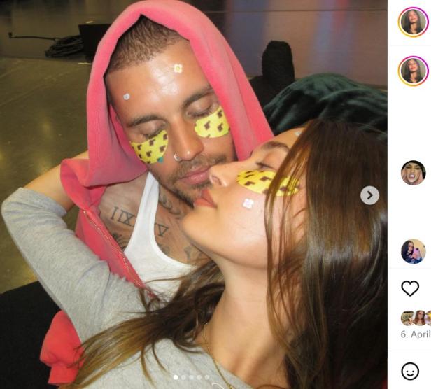 Justin und Hailey Bieber mit Antipickel und Augen-Patches